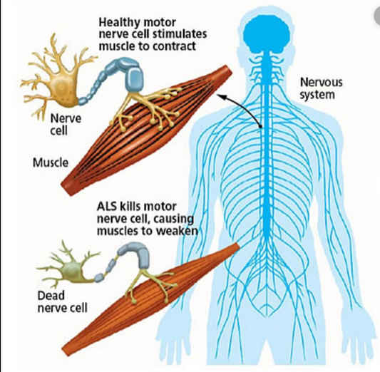 + 6 Ways to Help Manage ALS Symptoms...