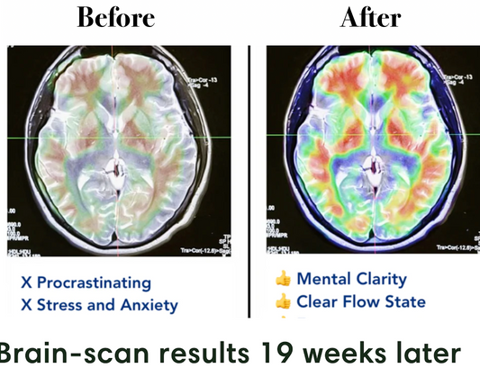 Using DeepSeek for prevention of cognitive impairment!